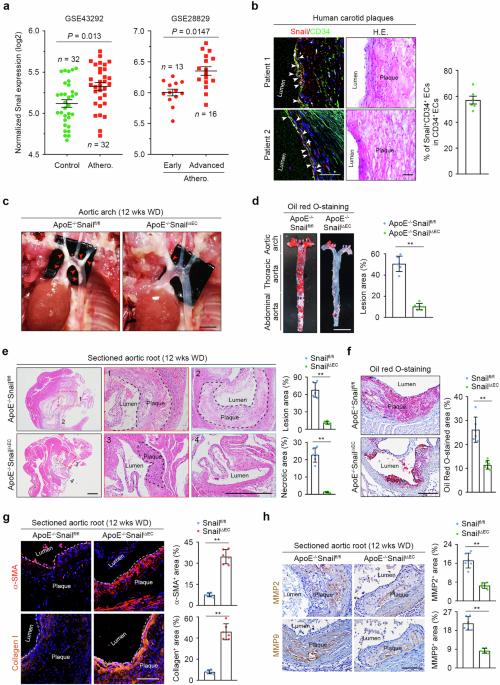 Genetic and pharmacological targeting of Snail inhibits atherosclerosis by relieving intraplaque endothelium dysfunction and associated inflammation