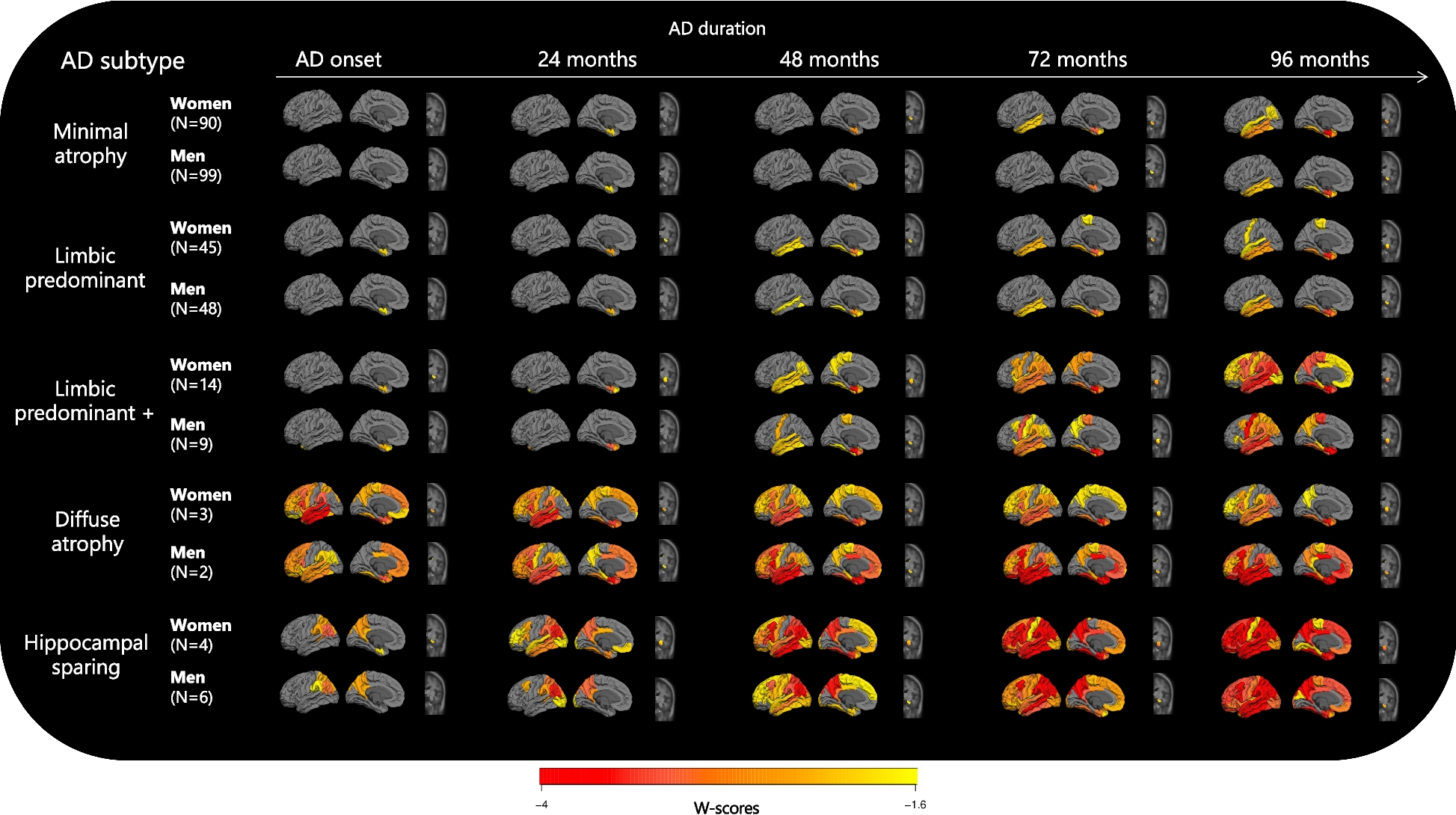 Atrophy trajectories in Alzheimer’s disease: how sex matters