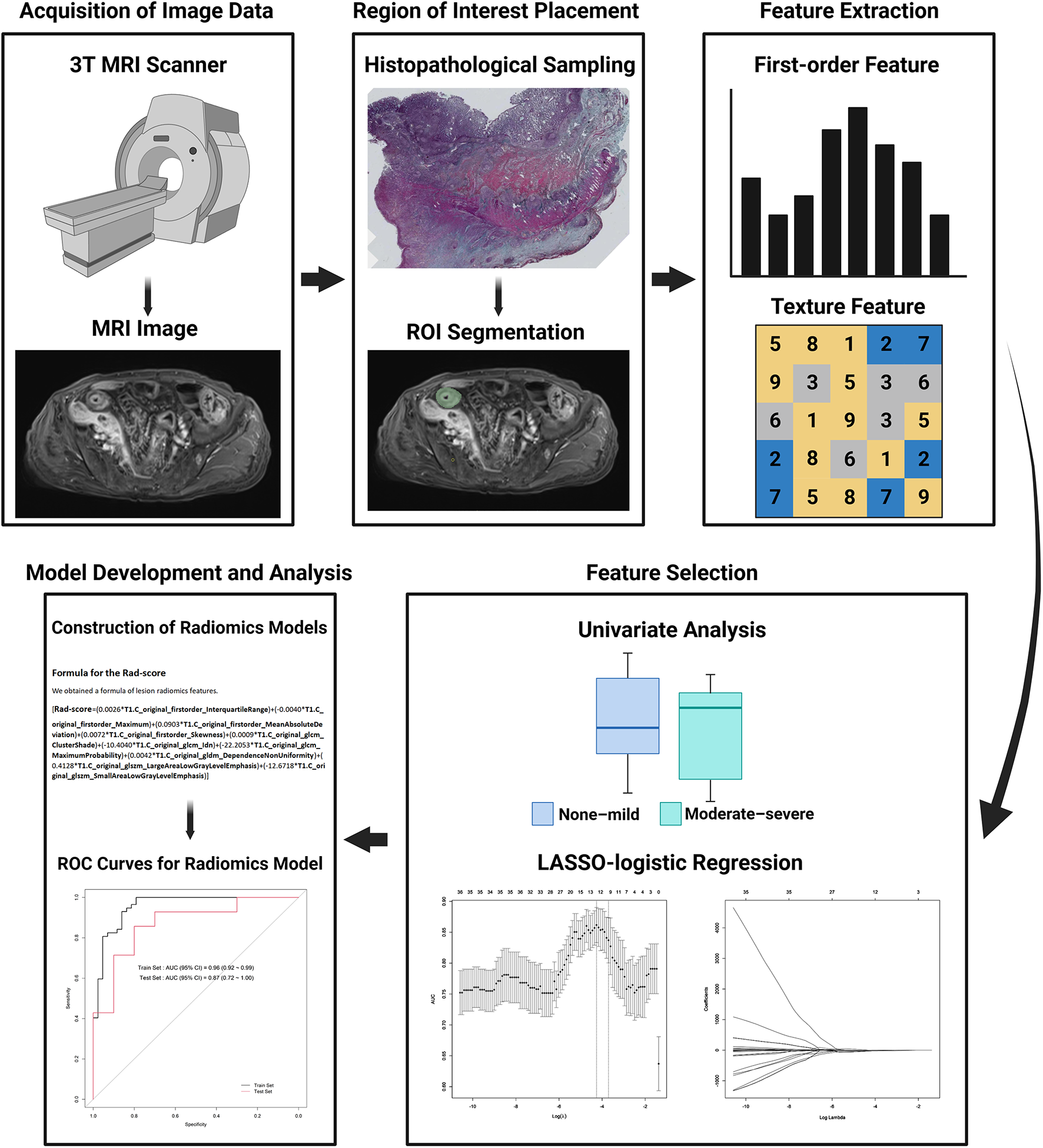 Quantitative MRI radiomics approach for evaluating muscular alteration in Crohn disease: development of a machine learning-nomogram composite diagnostic tool