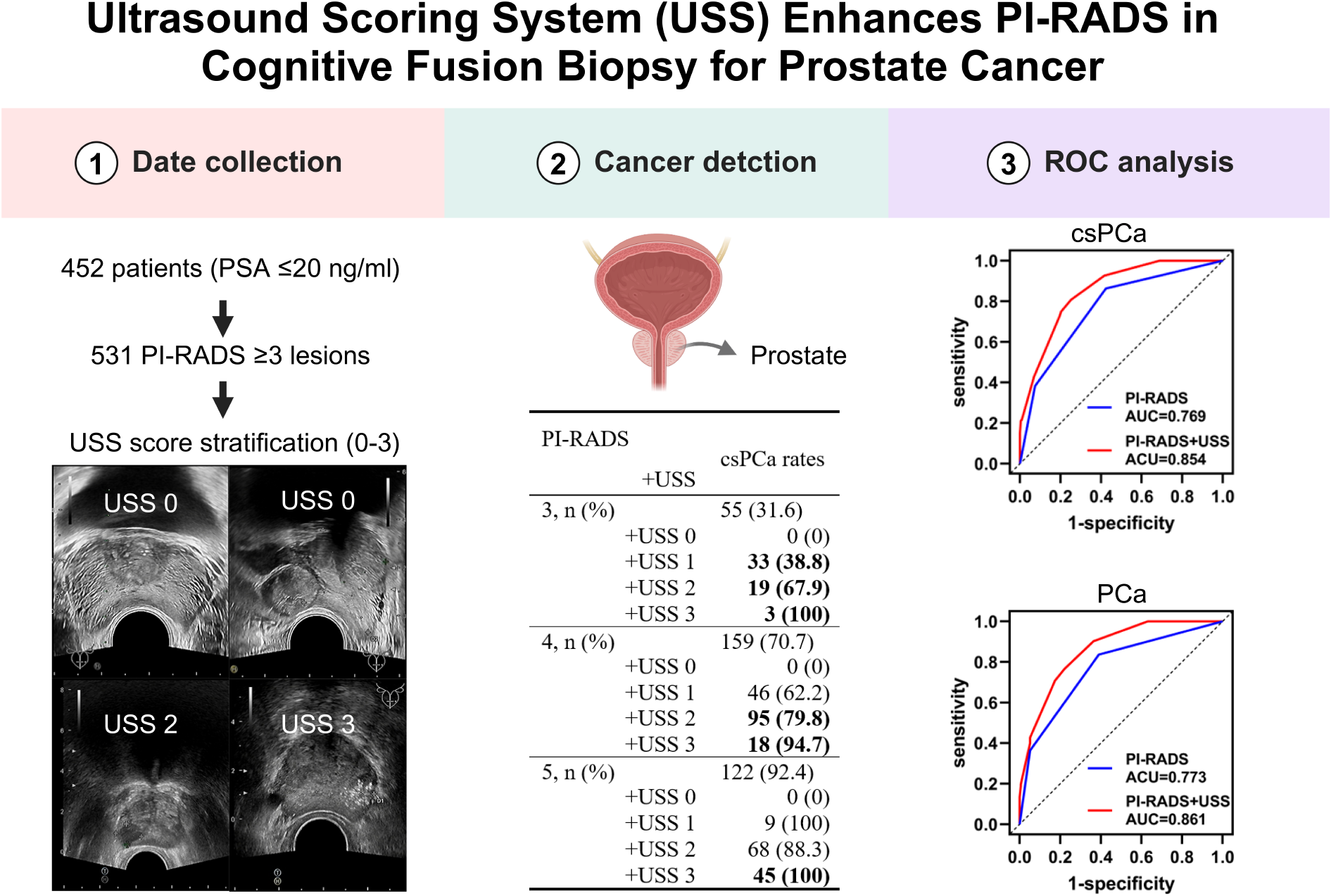 Novel ultrasound scoring system to guide cognitive fusion-targeted biopsy: a prospective study