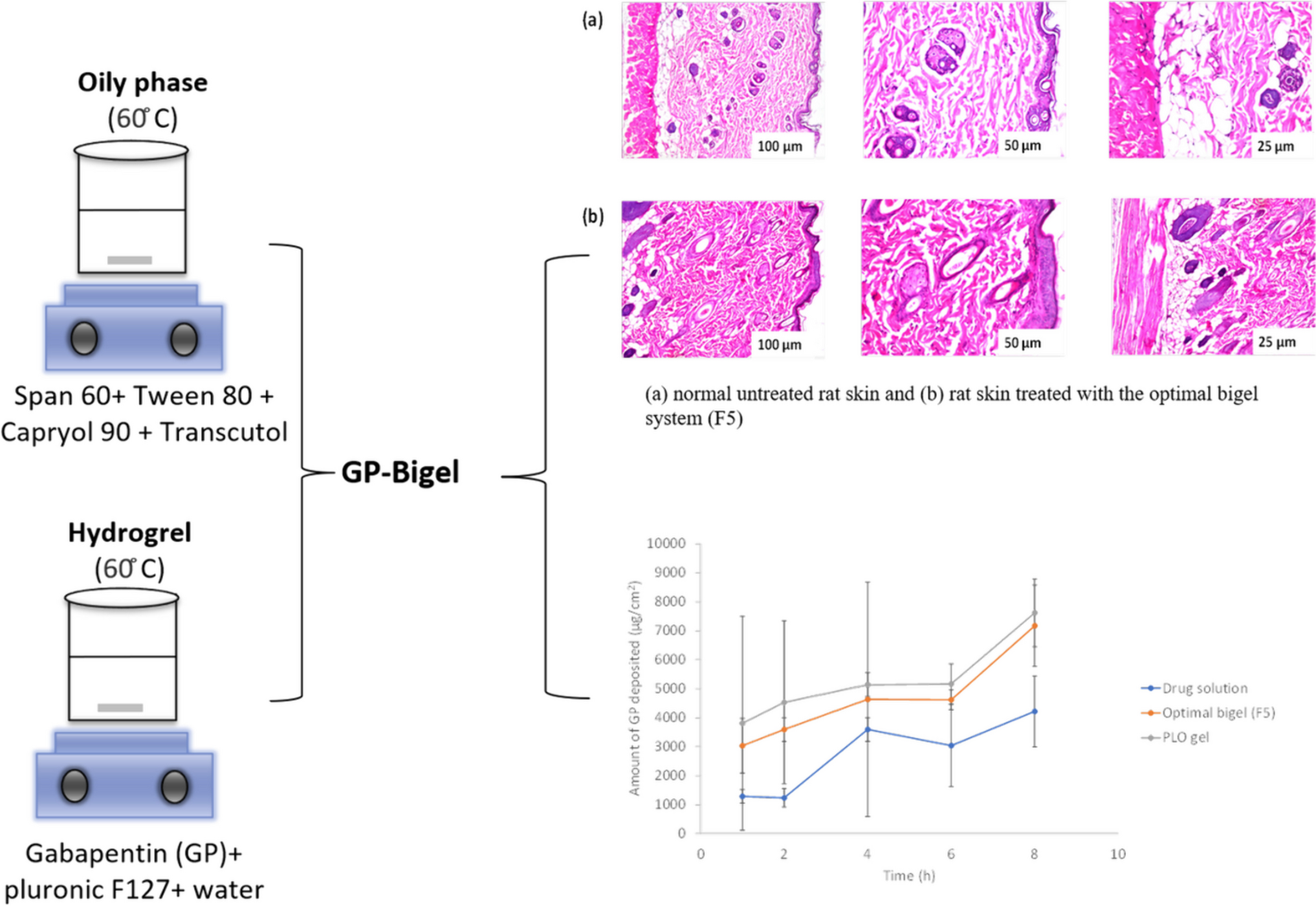Relieving postherpetic neuralgia pain via gabapentin-loaded bigels as an auspicious topical drug delivery system