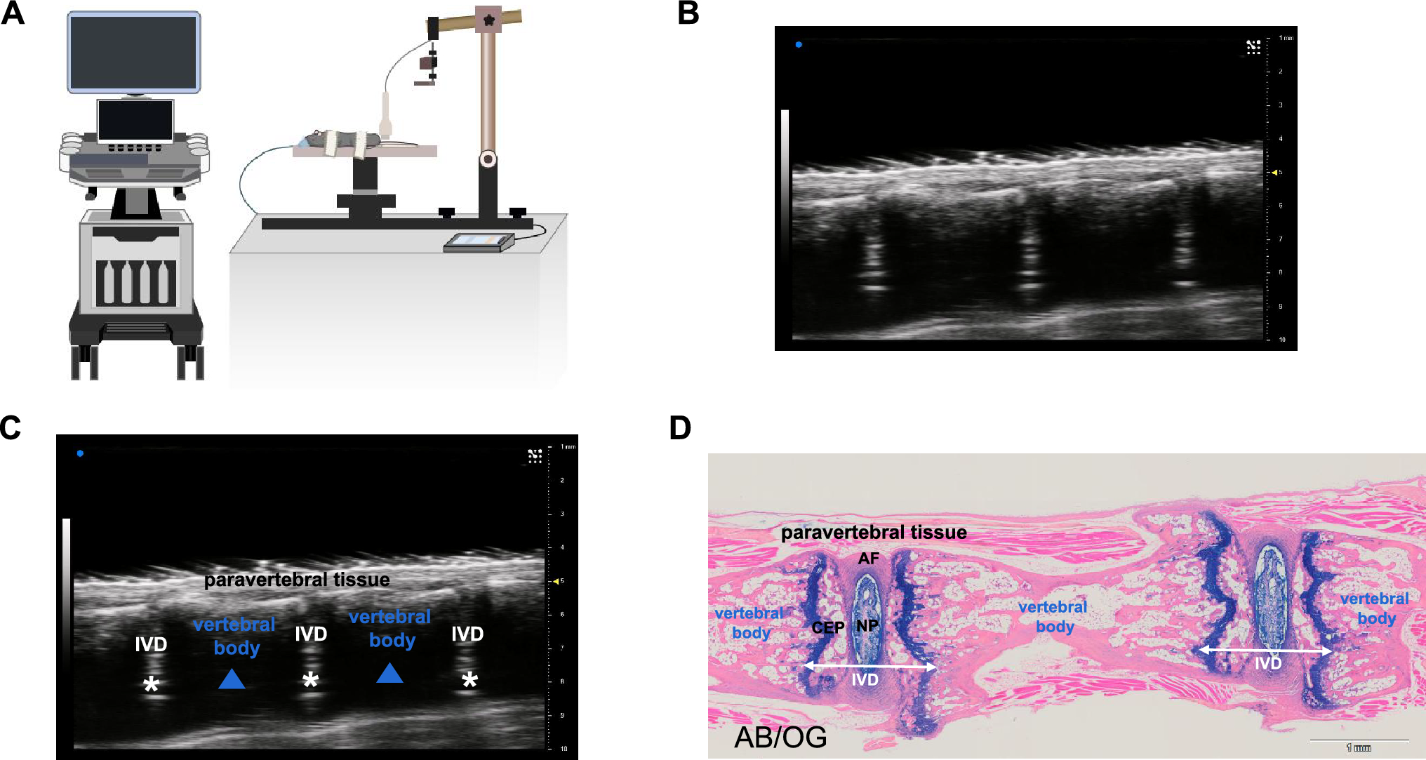 Ultrasound guidance for intervertebral disc location and paravertebral tissue swelling quantification in a mouse model of intervertebral disc herniation