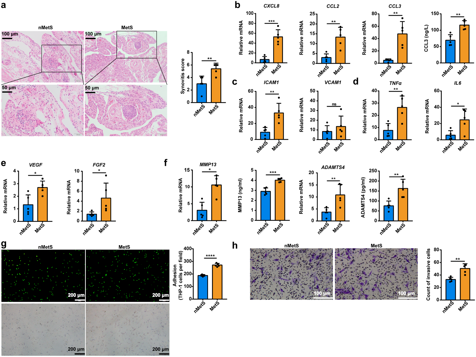 Resistin upregulates fatty acid oxidation in synoviocytes of metabolic syndrome-associated knee osteoarthritis via CAP1/PKA/CREB to promote inflammation and catabolism