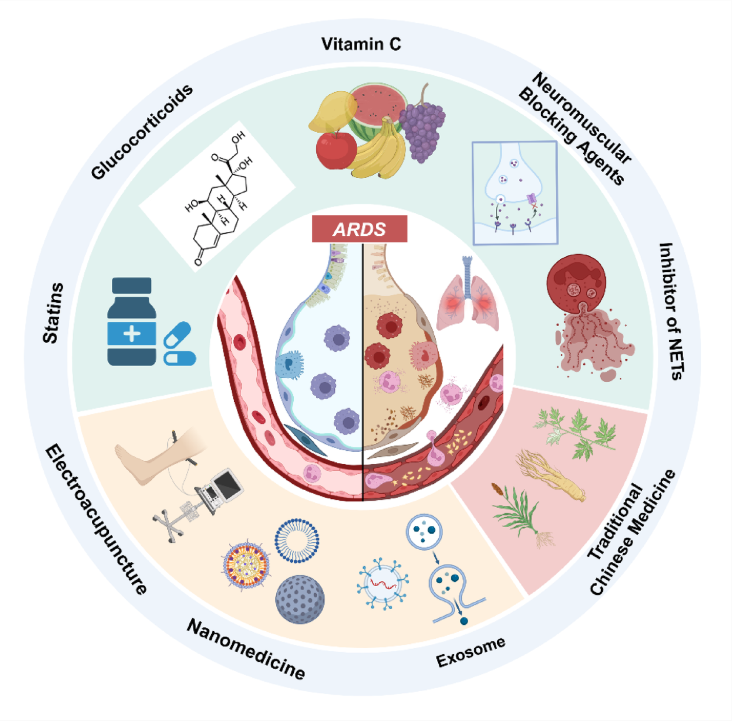 Advances in anti-inflammatory treatment of sepsis-associated acute respiratory distress syndrome