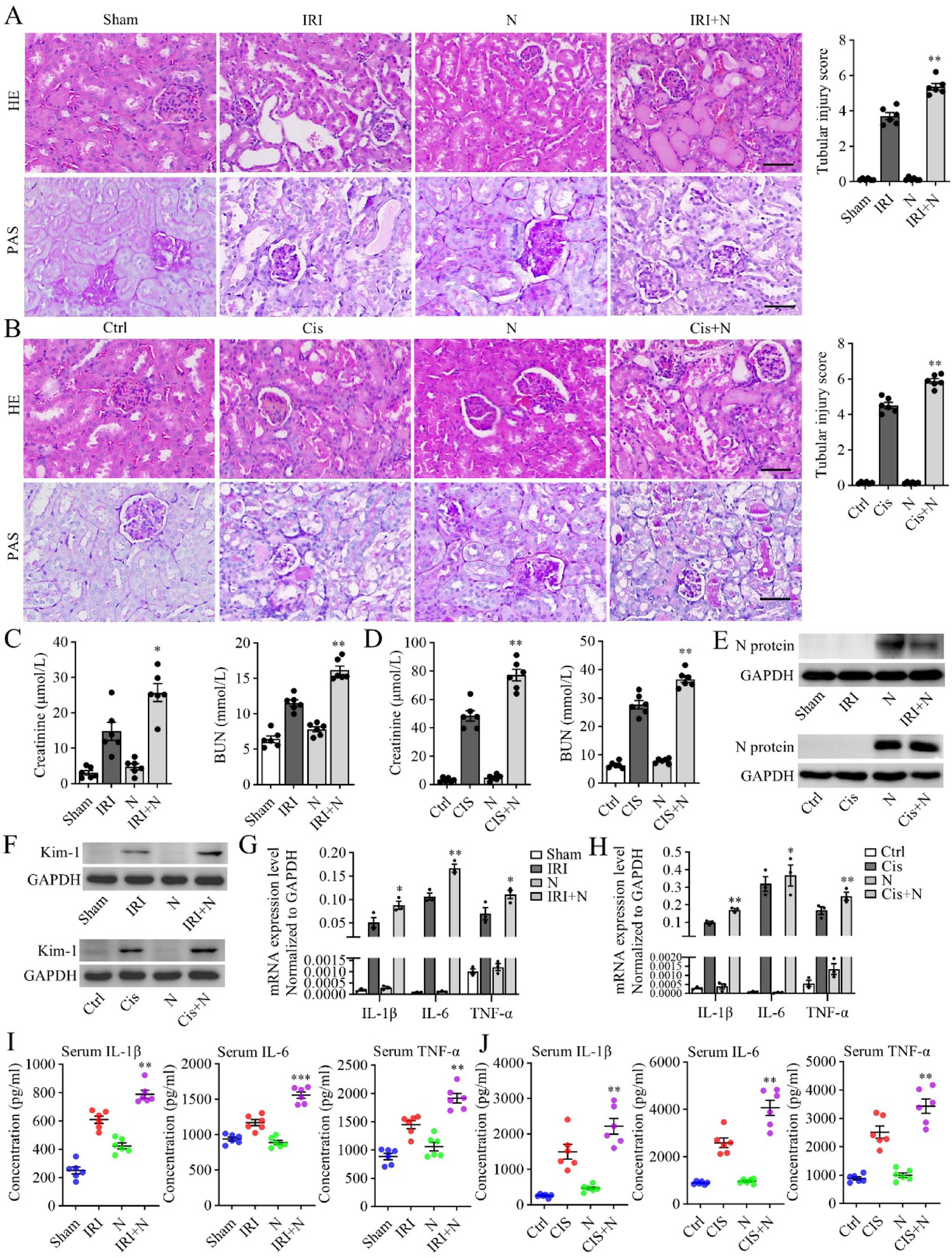 SARS-CoV-2 nucleocapsid protein induces a Mincle-dependent macrophage inflammatory response in acute kidney injury