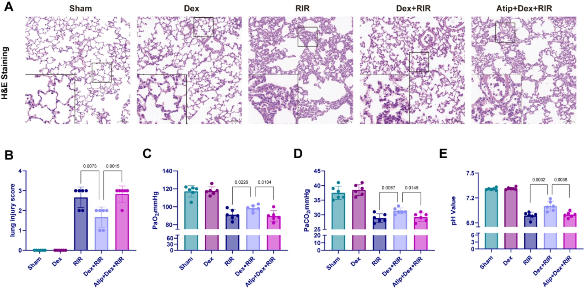 Alveolar macrophages polarization switch via α-adrenoceptor activation ameliorates pulmonary inflammation following kidney ischemia reperfusion