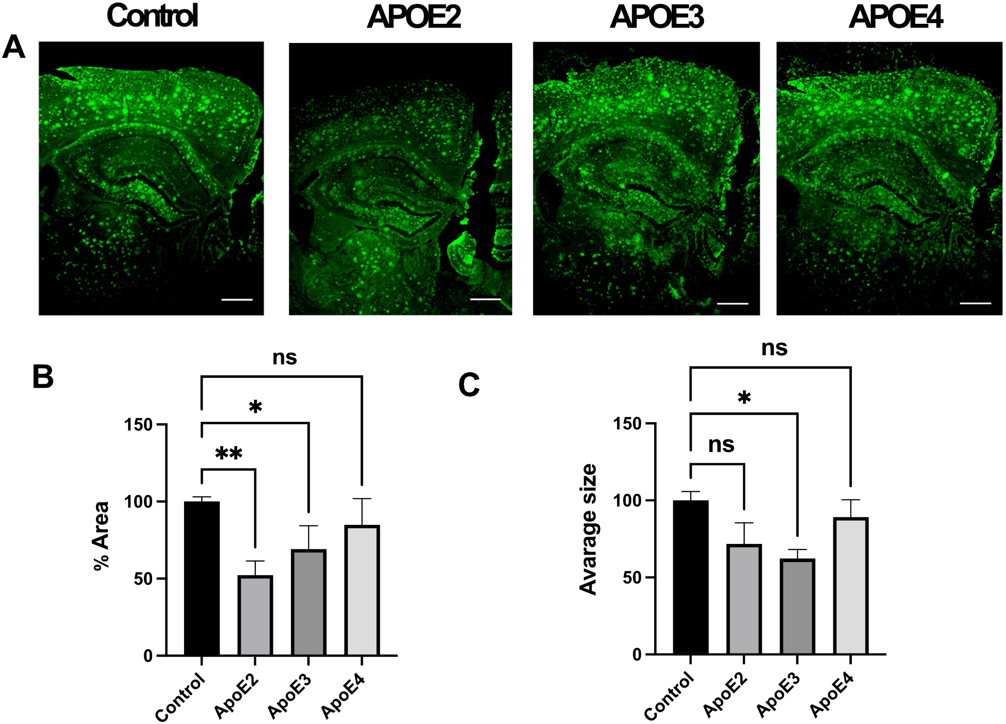 impairs autophagy and Aβ clearance by microglial cells