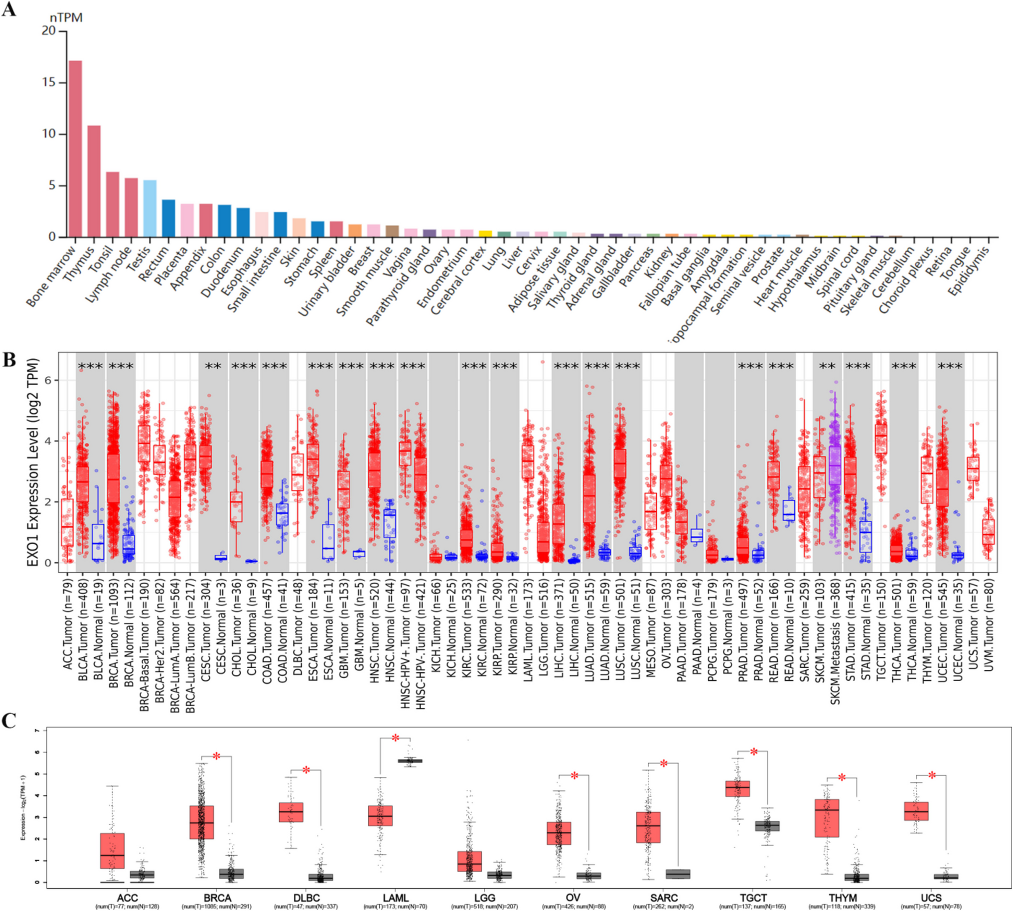 EXO1 as a potential biomarker for prognosis, immune infiltration, and immunotherapy in pan-cancer analysis