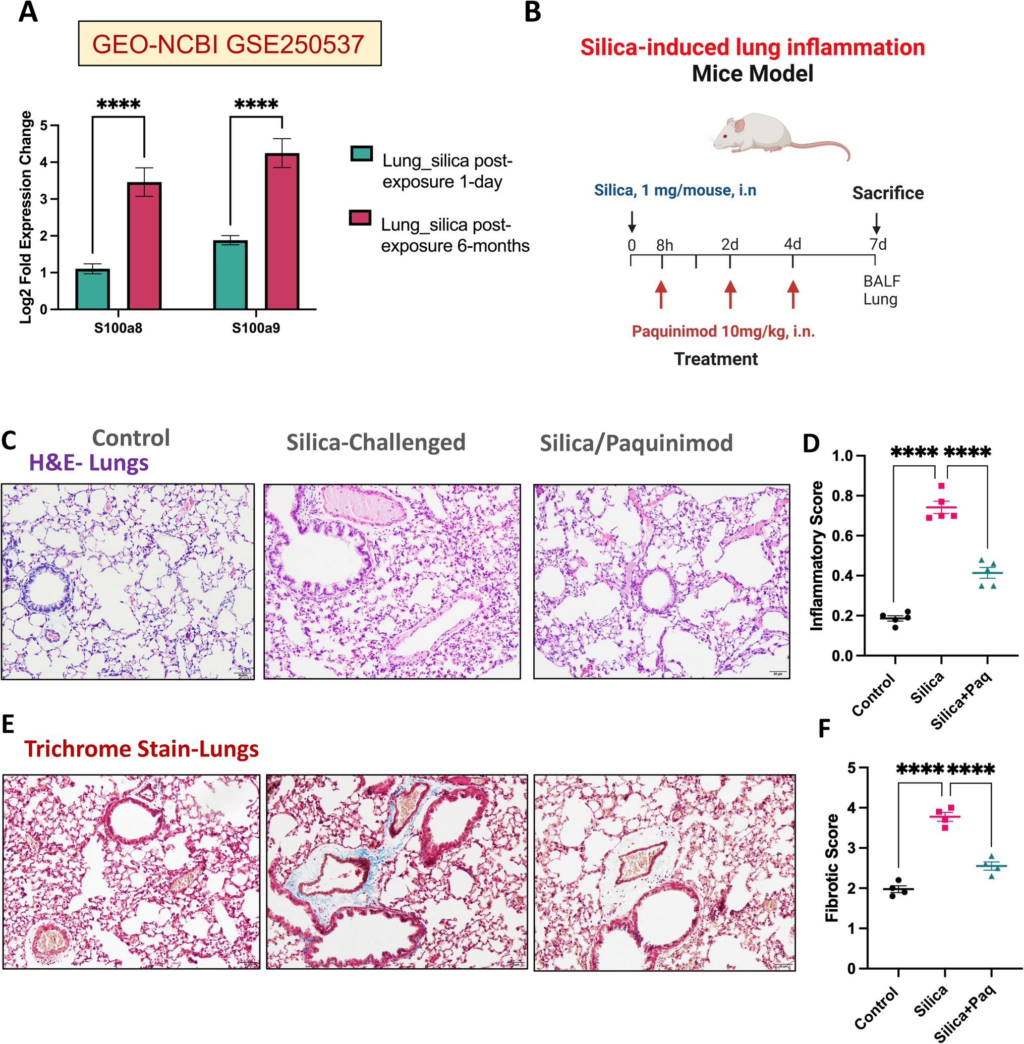 Calprotectin inhibition attenuates silica-induced lung fibrosis