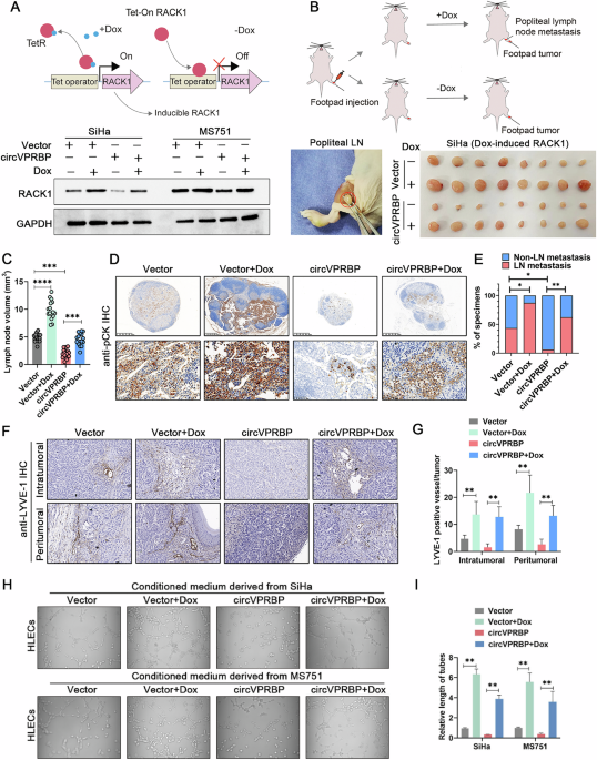 Correction: CircVPRBP inhibits nodal metastasis of cervical cancer by impeding RACK1 O-GlcNAcylation and stability