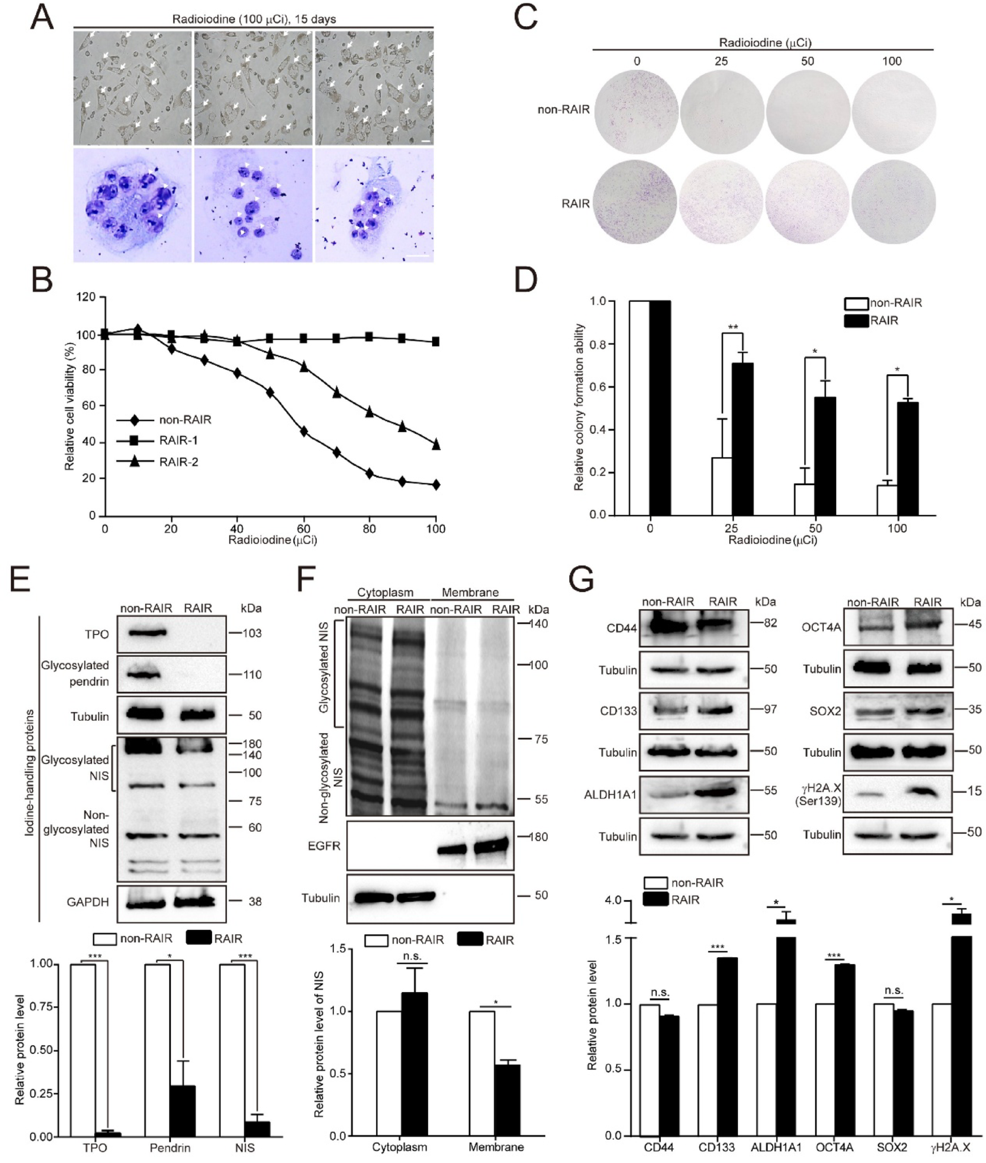 Lomibuvir sensitizes radioiodine-resistant thyroid cancer cell lines to radioiodine treatment by targeting hTERT RNA-dependent polymerase activity