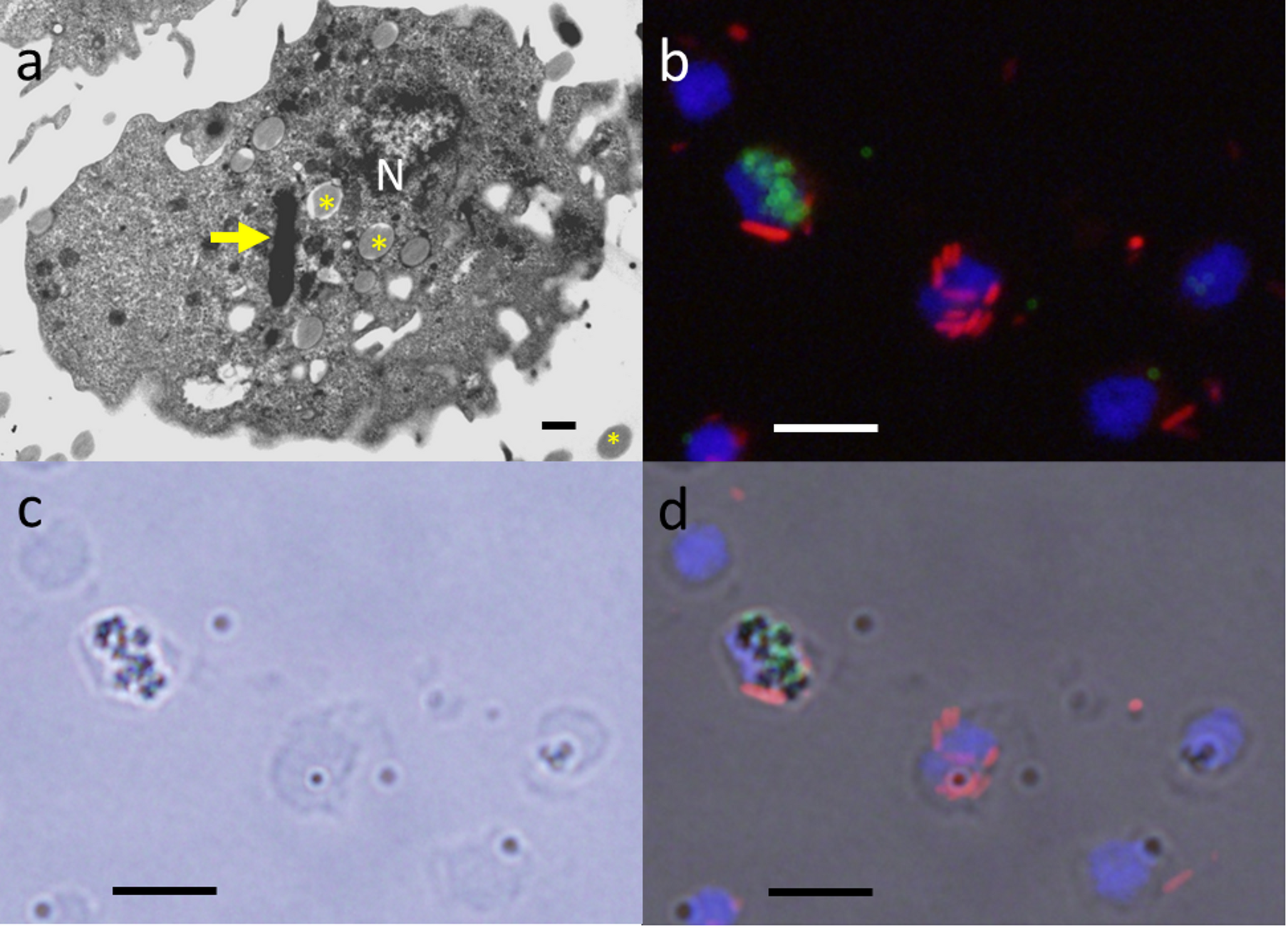 Micro- and nanoplastics reduce the phagocytosis and intracellular killing of  by THP1-Blue™ NFκB monocytes