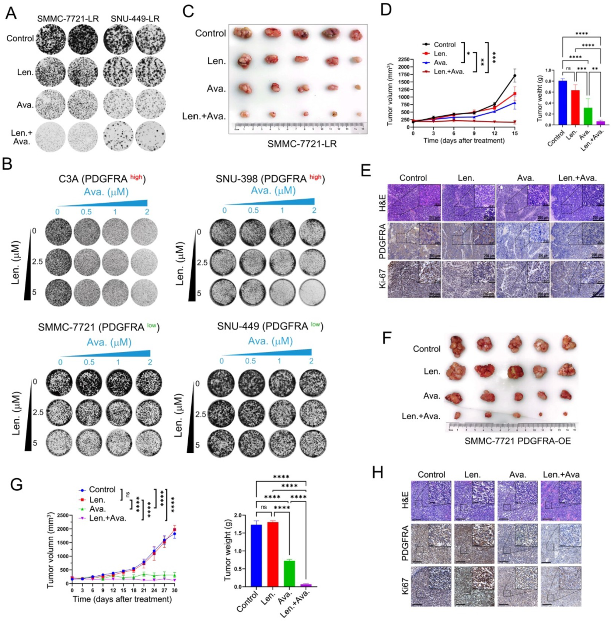 Correction: Targeted Inhibition of PDGFRA with avapritinib, markedly enhances lenvatinib efficacy in hepatocellular carcinoma in vitro and in vivo: clinical implications