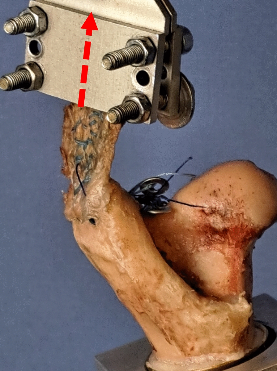 A novel augmentation technique for the repair of full thickness gluteal tendon tears: a biomechanical analysis in an ovine model