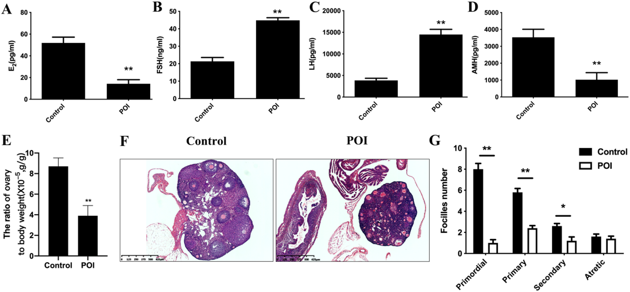 Mast cell tryptase-PAR2 axis promotes ovarian fibrosis through RNF152-mediated stabilization of Bcl-xL.