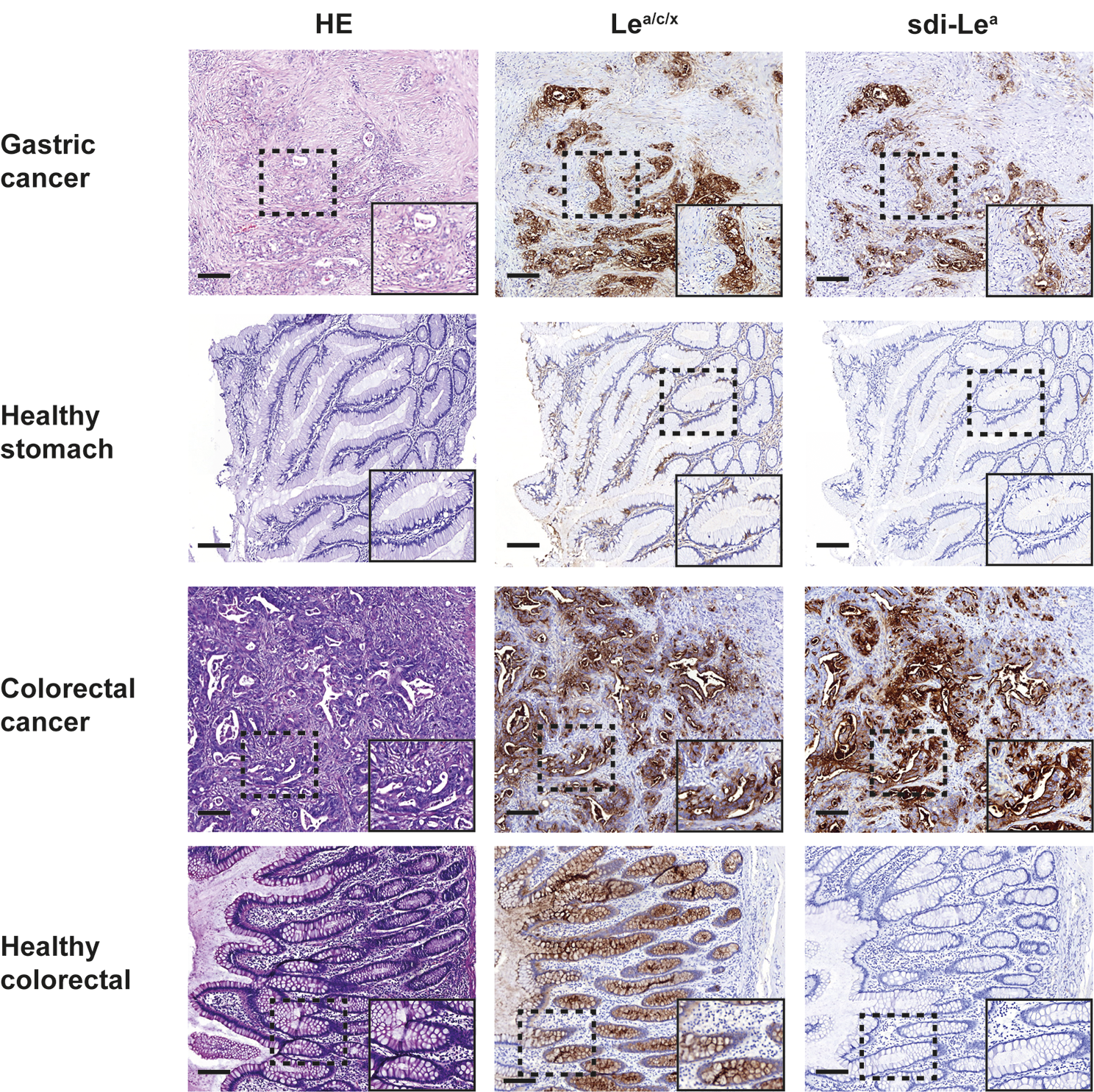 Preclinical evaluation of glycan-targeting monoclonal antibodies for bimodal near-infrared fluorescence and photoacoustic imaging of gastrointestinal cancers