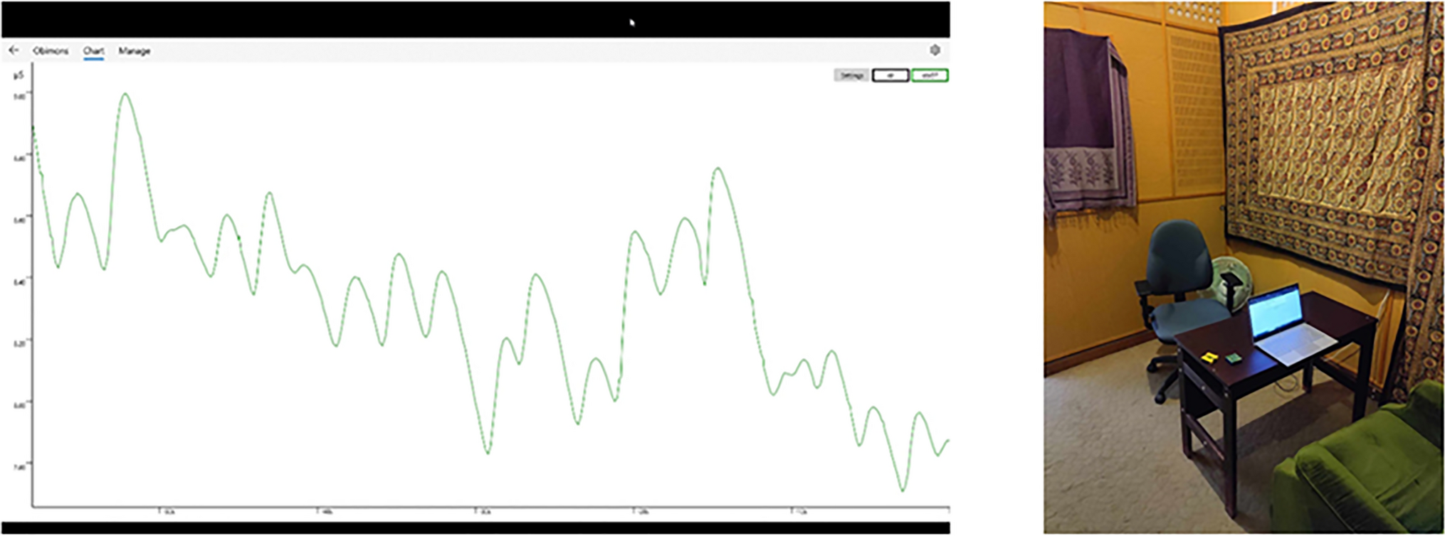 Feasibility of a Single-Session Electrodermal Biofeedback Intervention for State Anxiety