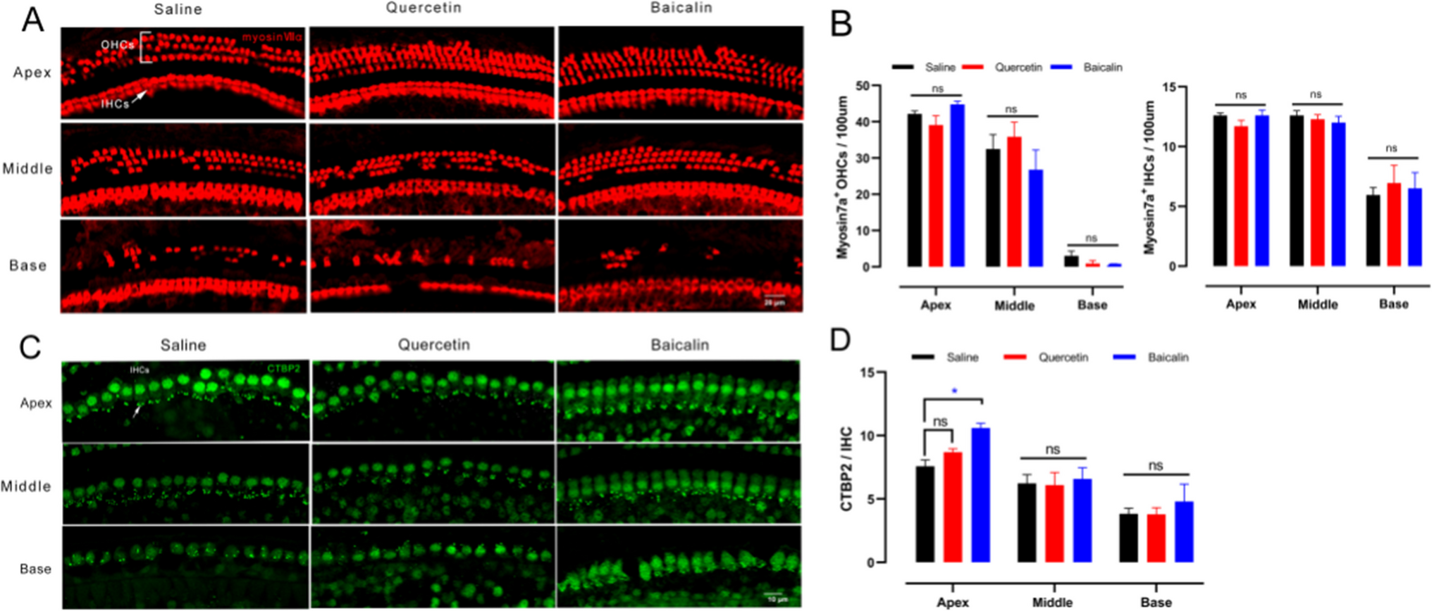 Correction to: Exploring the bioactive ingredients of three traditional Chinese medicine formulas against age-related hearing loss through network pharmacology and experimental validation