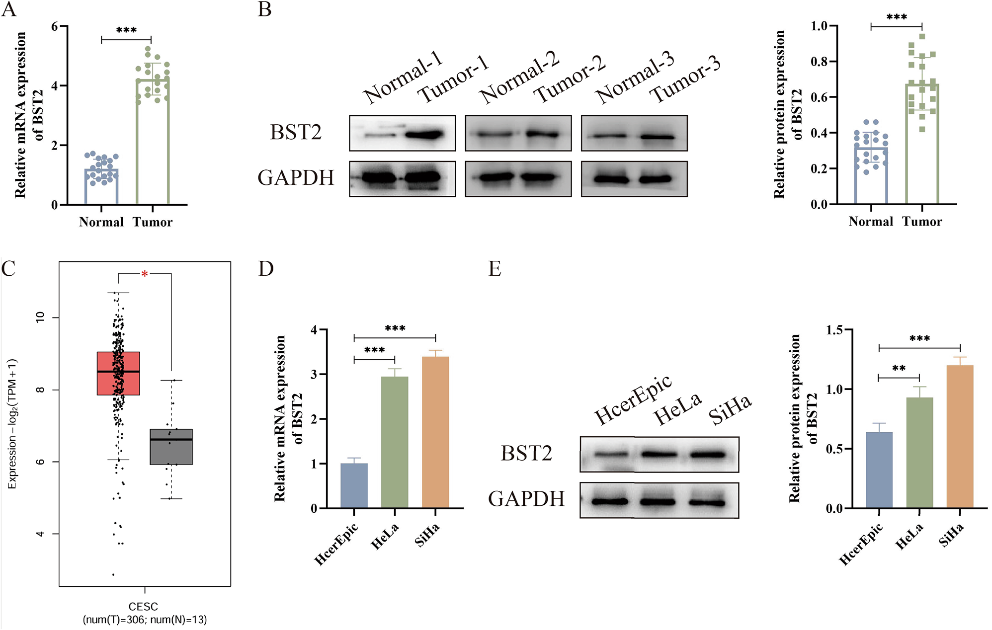 DNA hypomethylation modification promotes BST2 expression in cervical cancer by facilitating STAT1 binding to the promoter of BST2