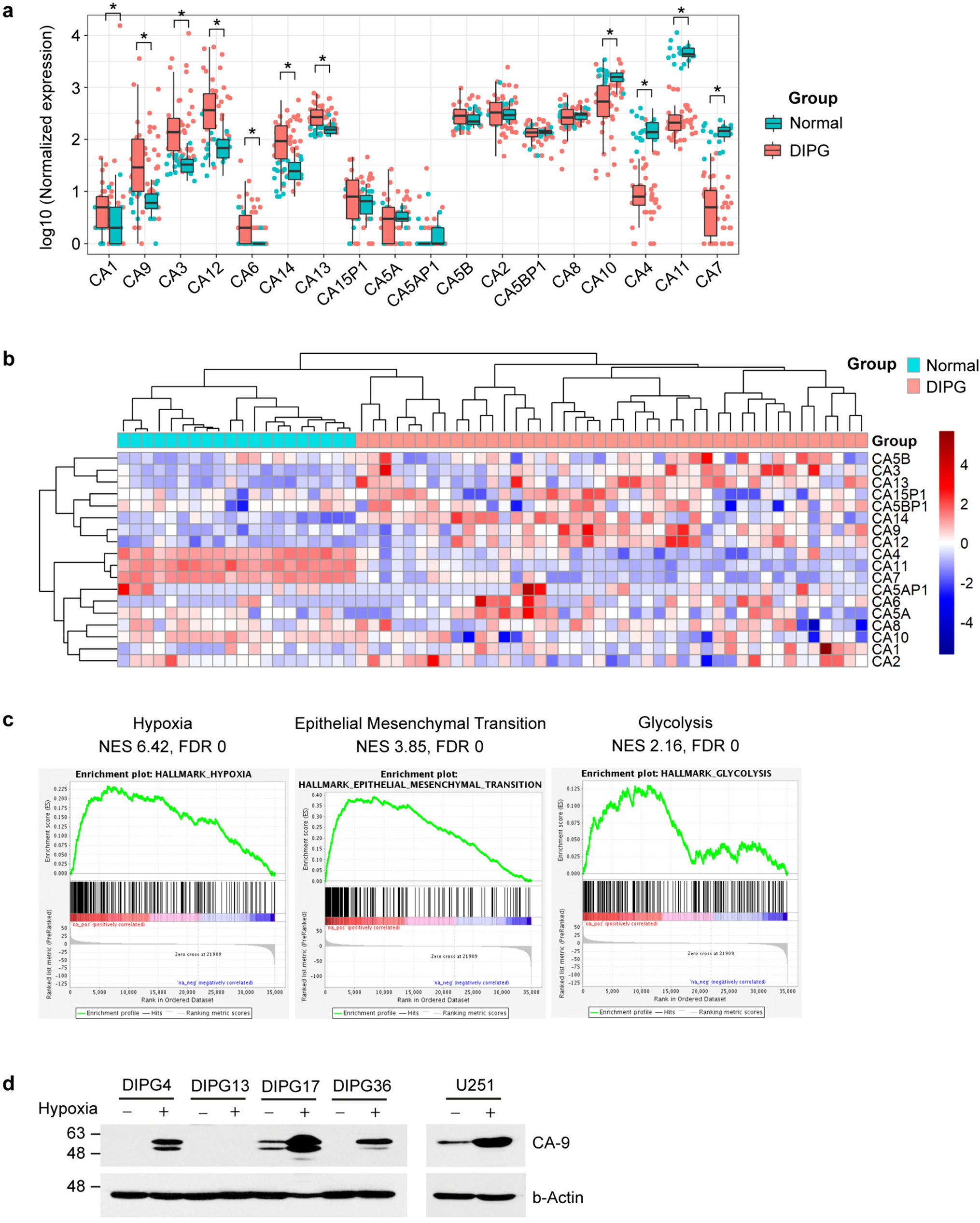 Combination treatment with histone deacetylase and carbonic anhydrase 9 inhibitors shows therapeutic potential in experimental diffuse intrinsic pontine glioma