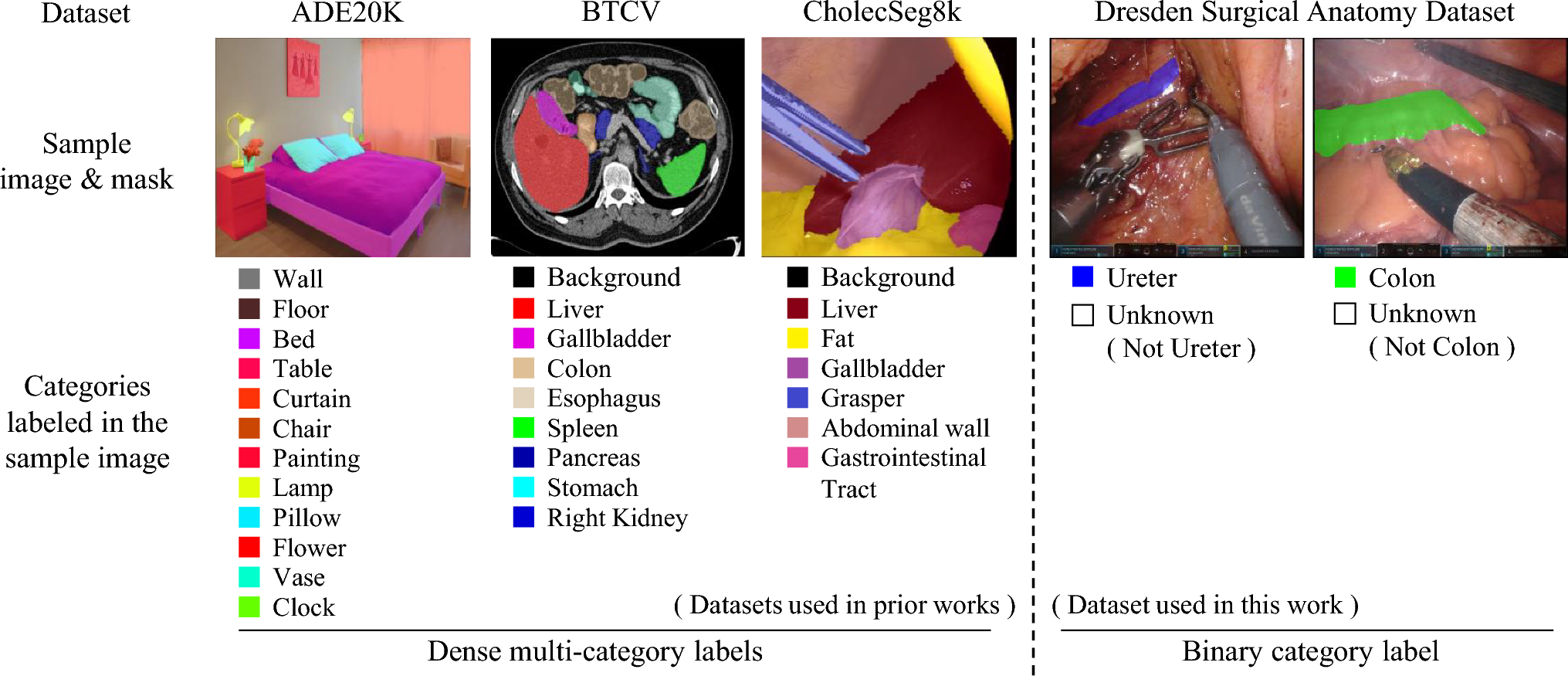 Diffusion-driven distillation and contrastive learning for class-incremental semantic segmentation of laparoscopic images