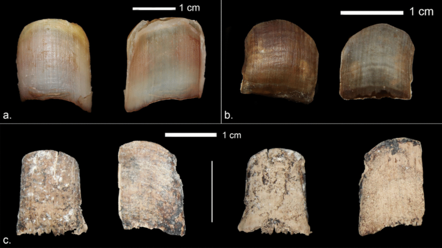 Three-step forensic approach for the differentiation of human and pig fingernail-like fragments: macroscopic examination, raman spectroscopy and histogenetic analyses
