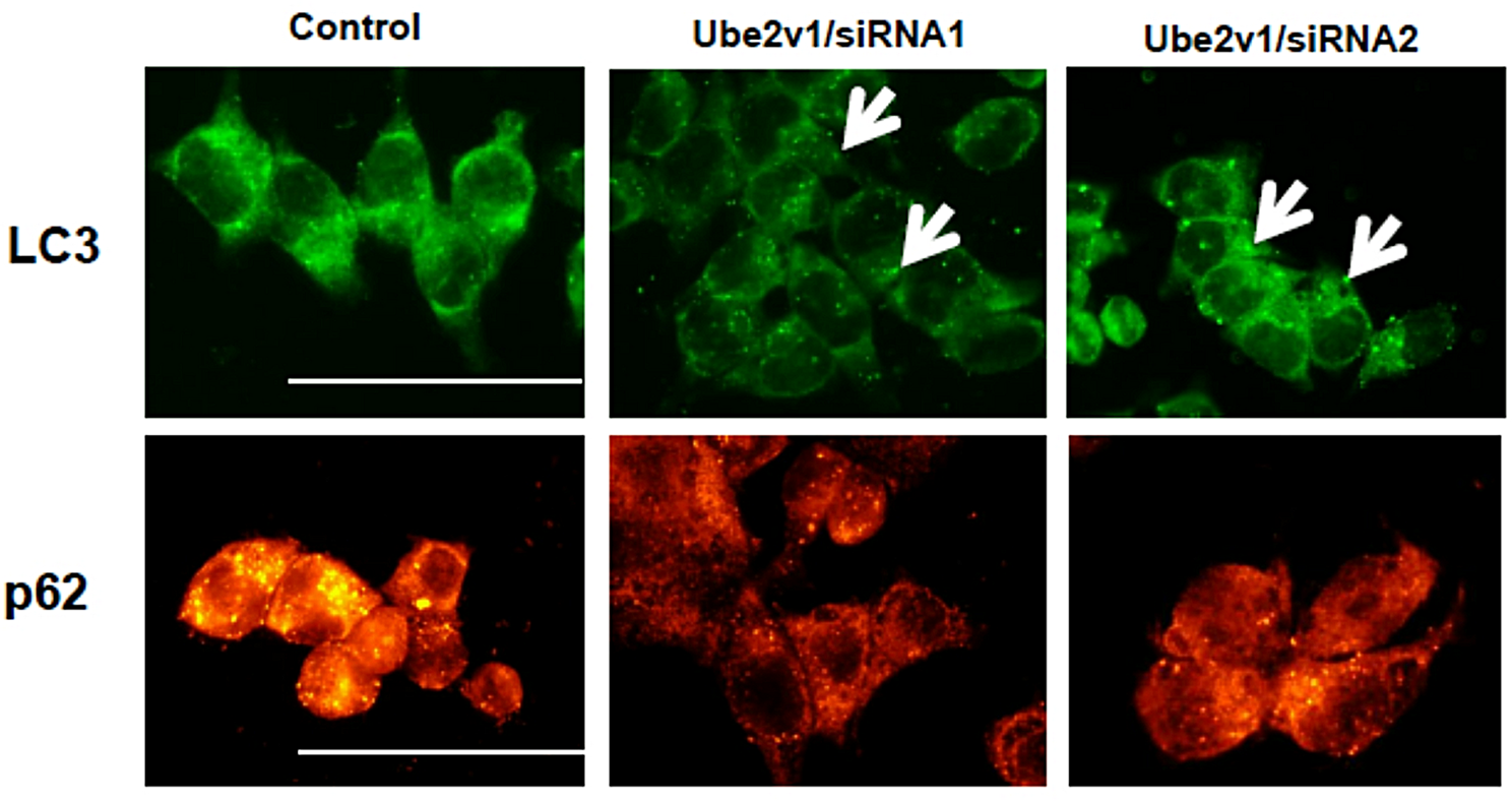 Correction: Ube2v1-mediated ubiquitination and degradation of Sirt1 promotes metastasis of colorectal cancer by epigenetically suppressing autophagy