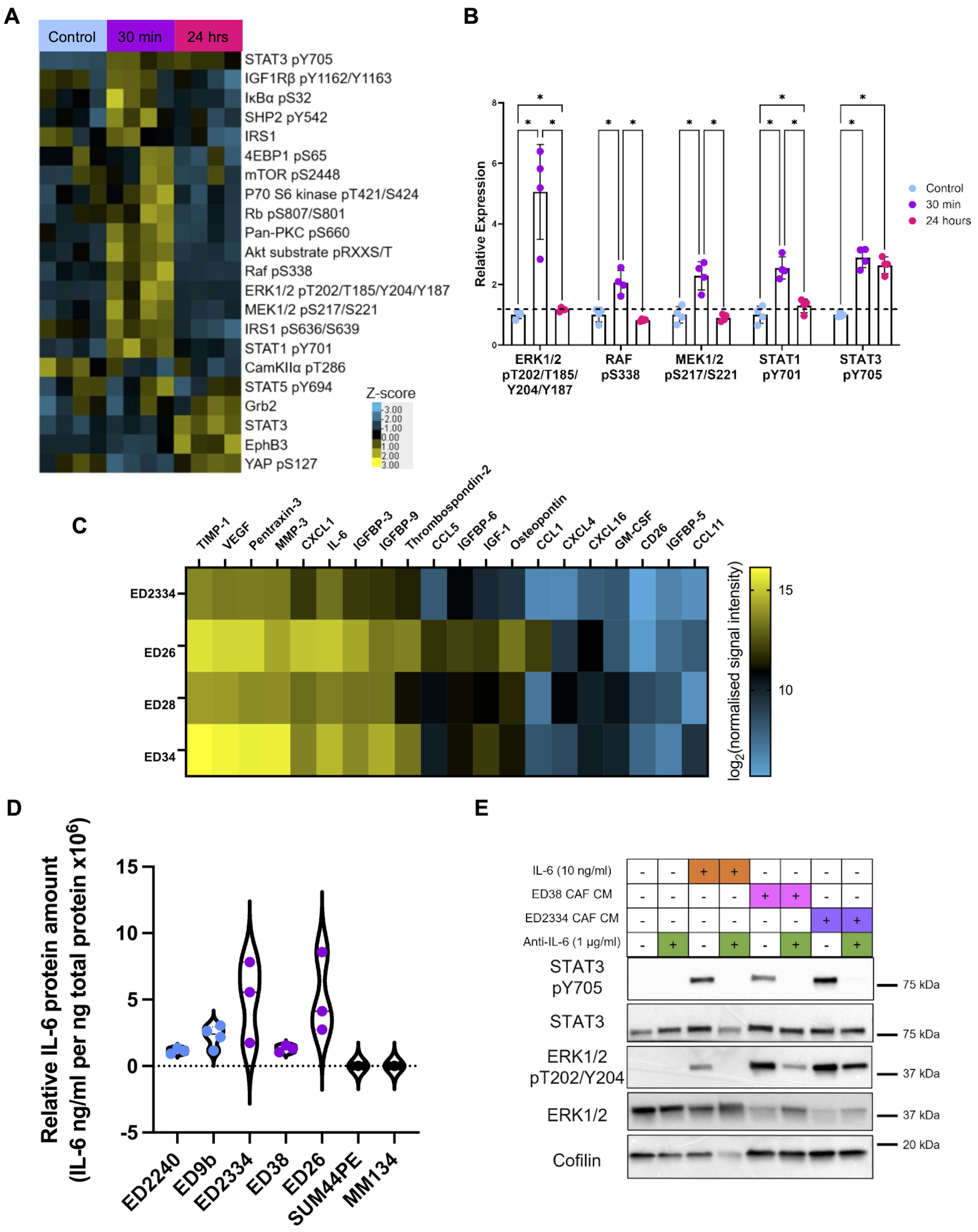 Cancer-associated fibroblast driven paracrine IL-6/STAT3 signaling promotes migration and dissemination in invasive lobular carcinoma