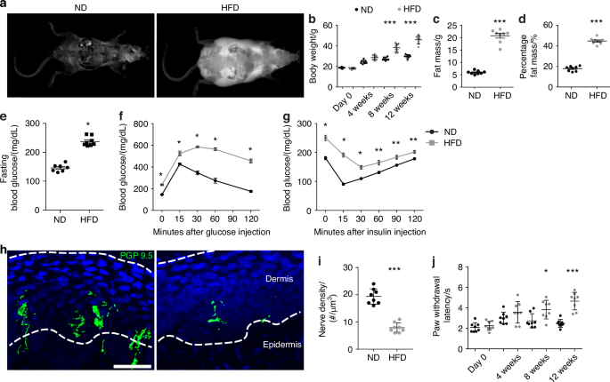 Reduced somatosensory innervation alters the skeletal transcriptome at a single cell level in a mouse model of type 2 diabetes