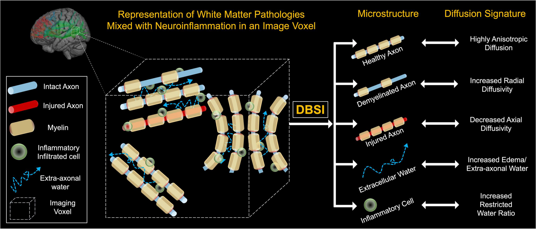 Diffusion basis spectrum imaging of white matter in schizophrenia and bipolar disorder