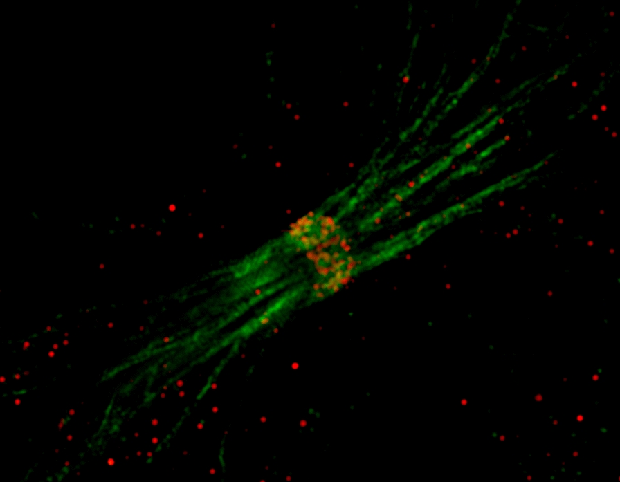 The multitalented TIP60 chromatin remodeling complex: wearing many hats in epigenetic regulation, cell division and diseases