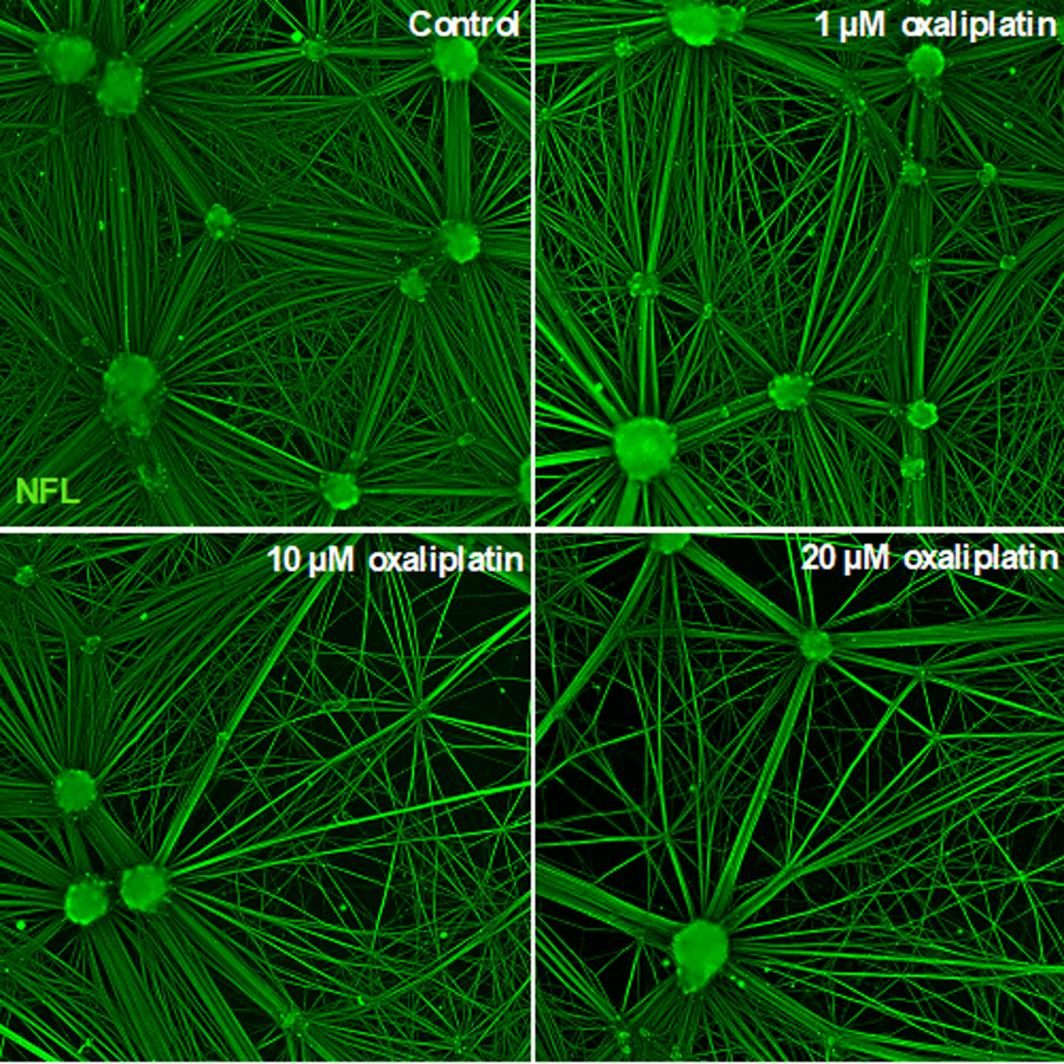 Neurofilament light chain as a marker for neuronal damage: integrating in vitro studies and clinical findings in patients with oxaliplatin-induced neuropathy