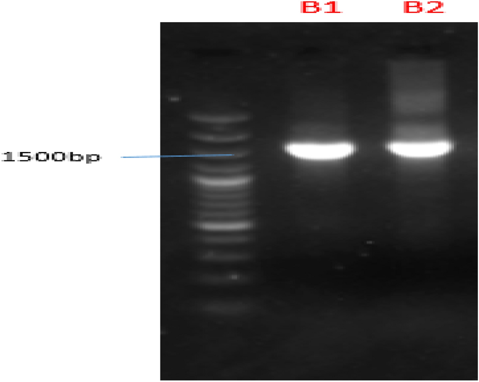 Biosynthesis and characterization of silver nanoparticles using , , and leaf extracts of  and  species