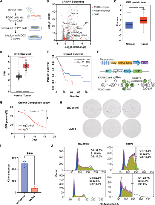 DR1 activates histone gene expression to maintain pancreatic cancer cell survival through the ATAC complex