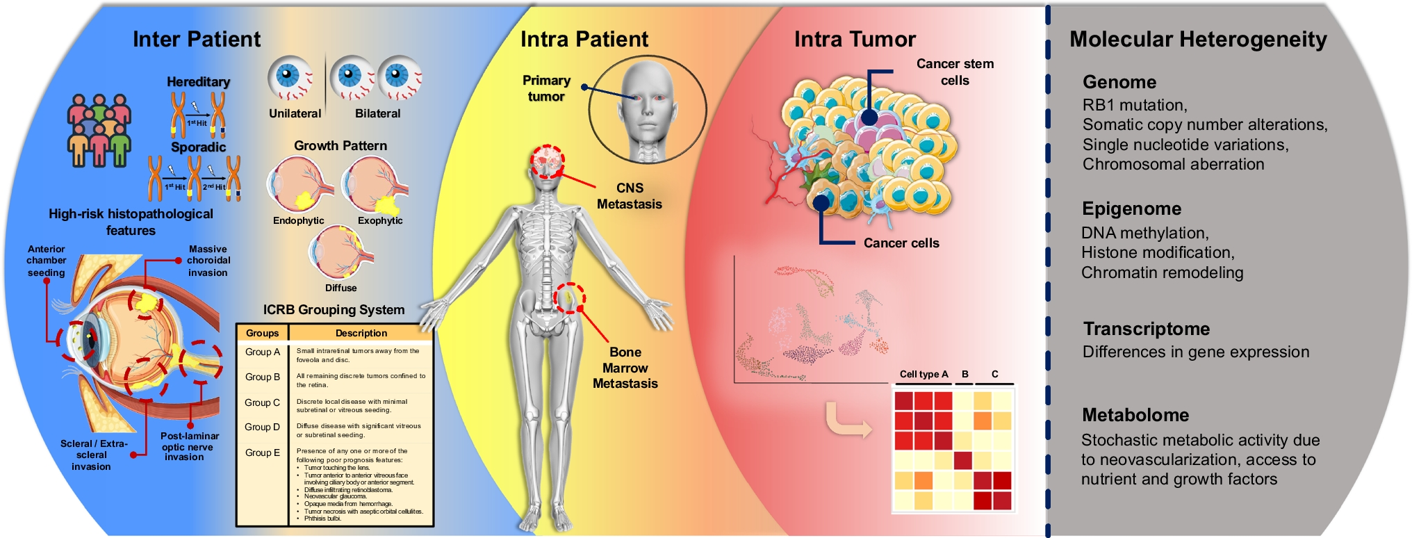 Tumor heterogeneity in retinoblastoma: a literature review