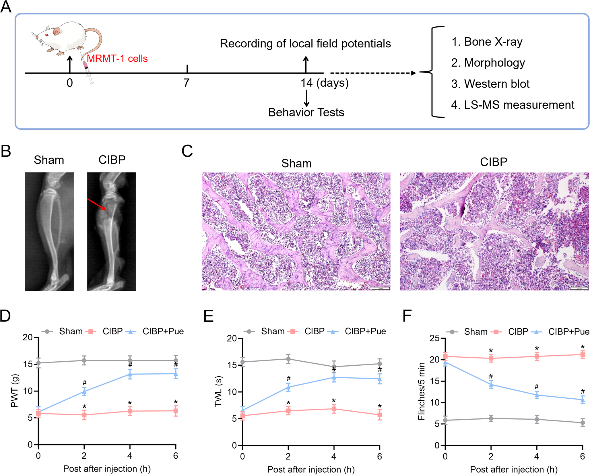 Puerarin Improves Cancer-Induced Bone Pain by Recovering Mitochondrial Dysfunction in the Spinal Cord