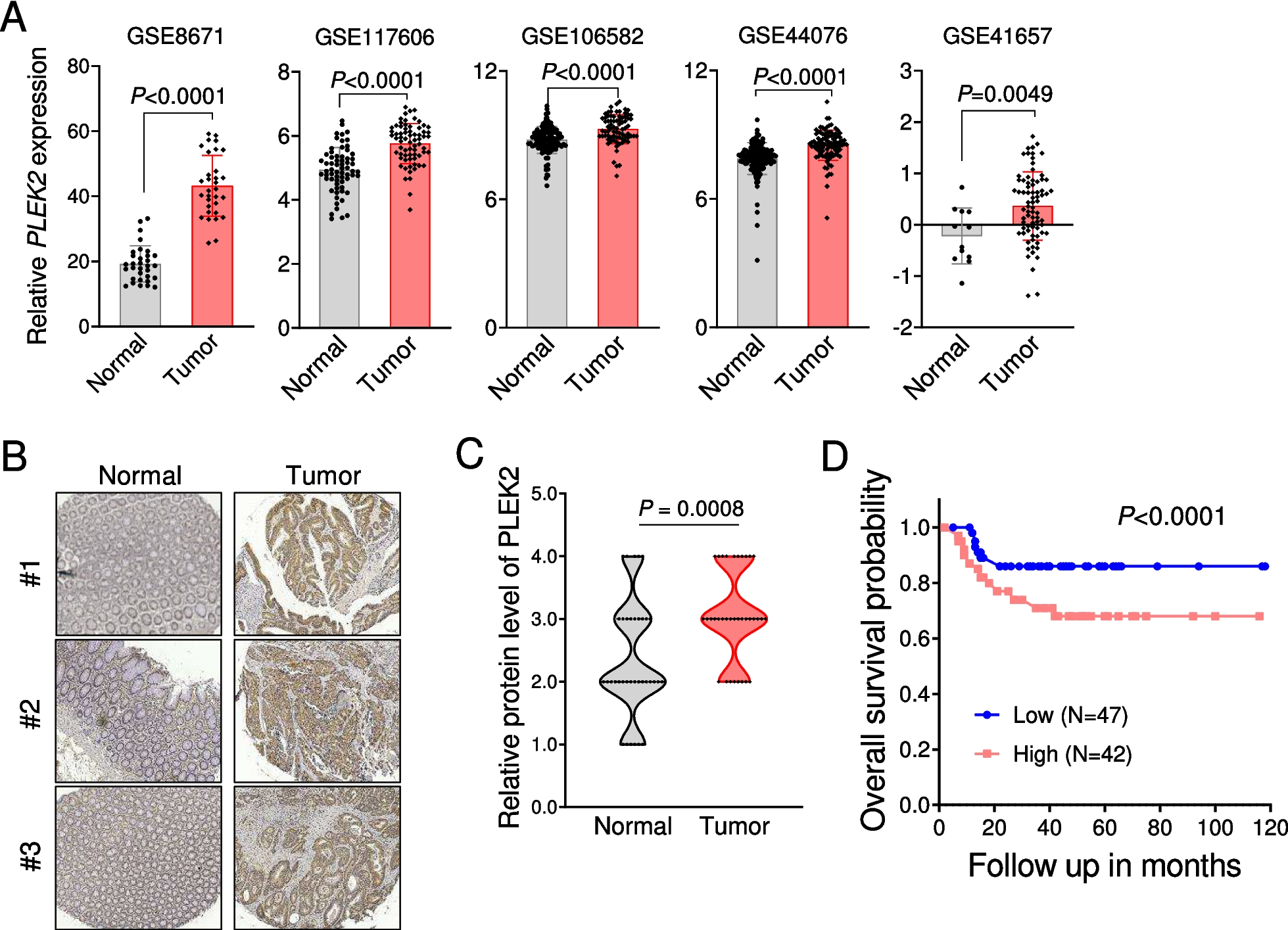 Pleckstrin-2 promotes the progression of colorectal cancer via YTHDF2-mediated TYMS mRNA stability