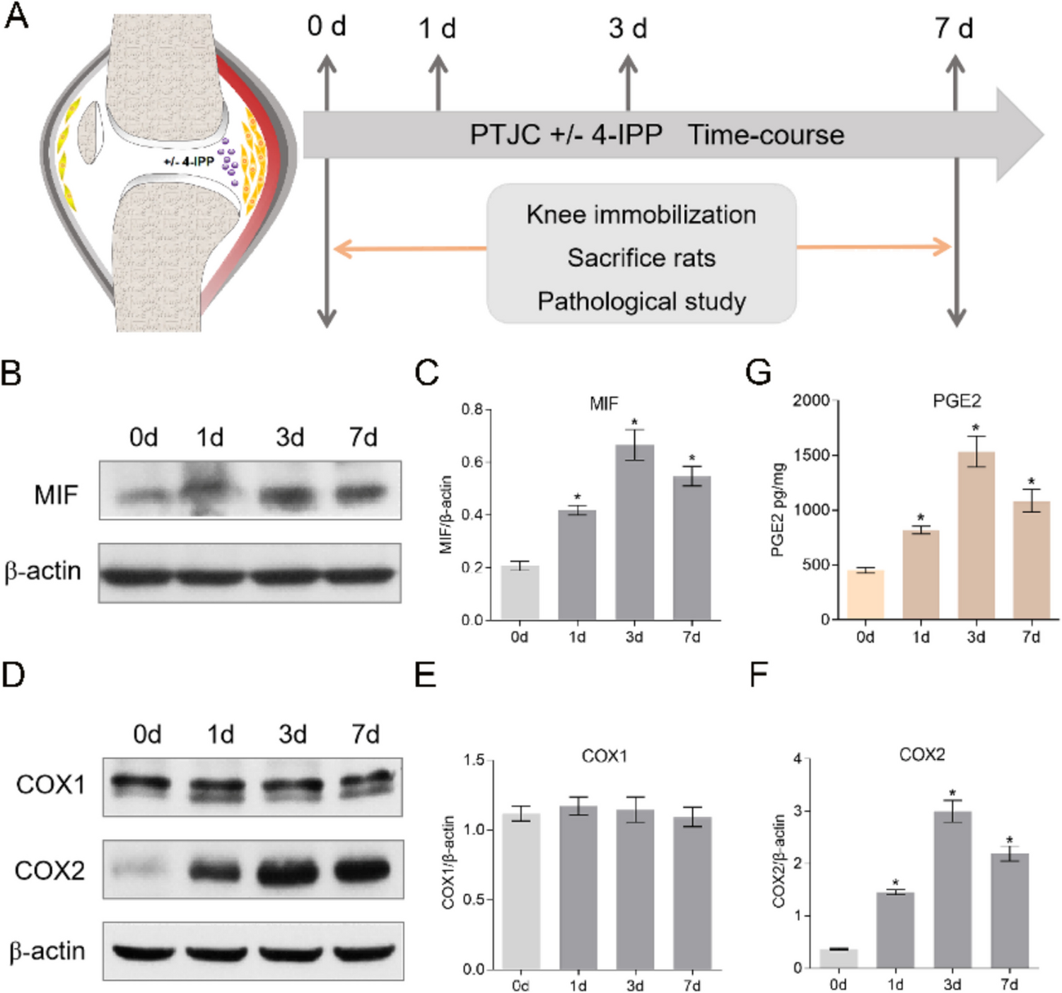 Macrophage migration inhibitory factor mediates joint capsule fibrosis via facilitating phospholipid metabolite PGE2 production in fibroblasts