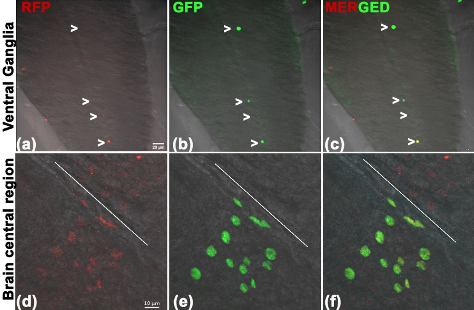 The  driver in  does not express in the eight pairs of dorsomedial and some other neurons in larval ventral ganglia: a correction
