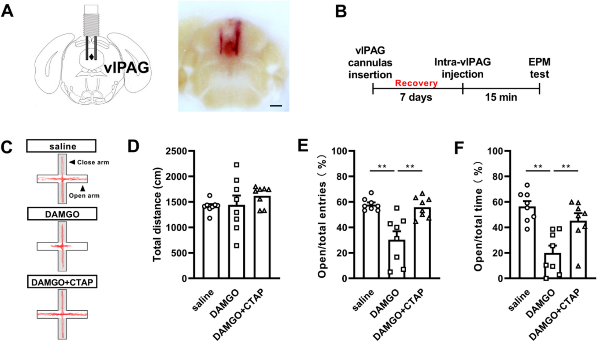 Role of astrocytic mu-opioid receptors of the ventrolateral periaqueductal gray in modulating anxiety-like responses
