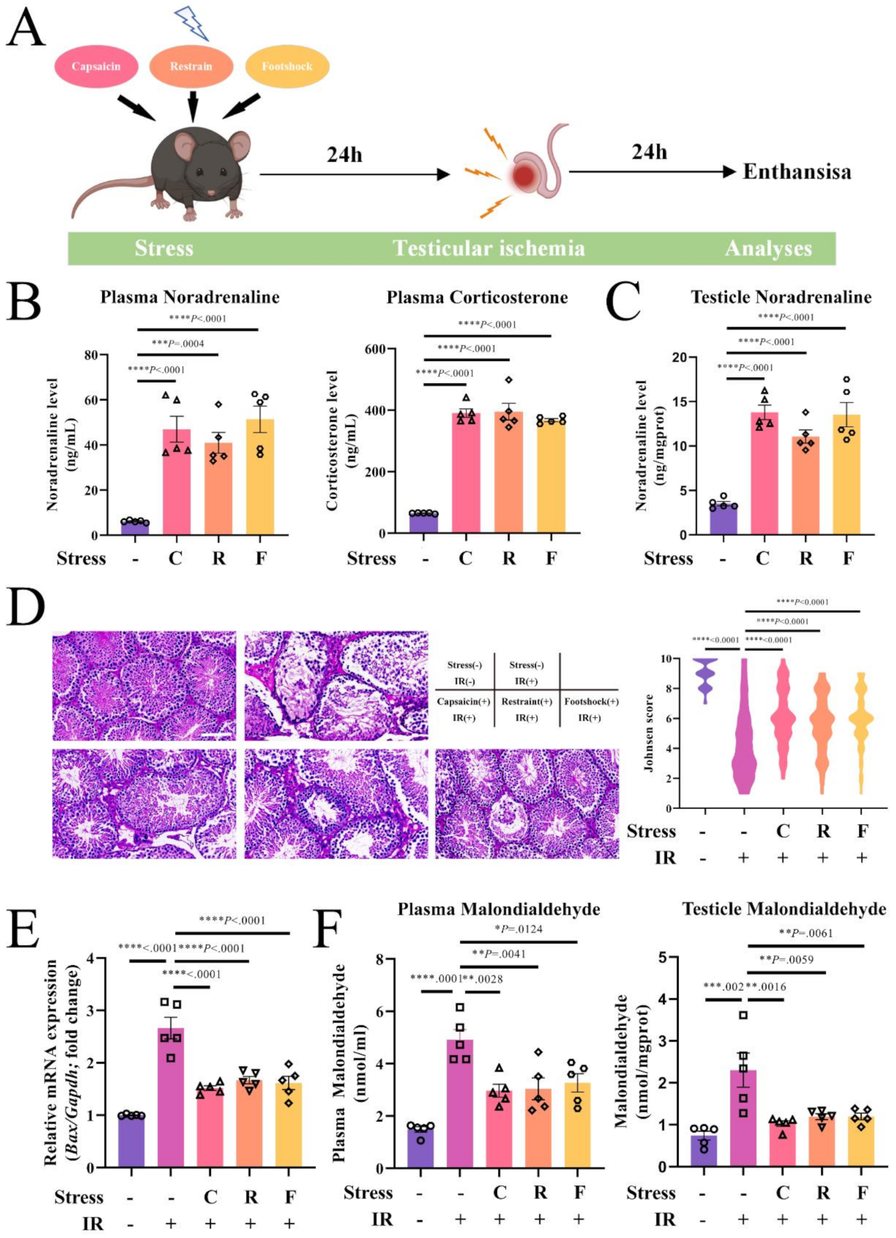 Short-term stress preconditioning activates sympathetic innervation in the testes to mitigate testicular ischemia-reperfusion injury
