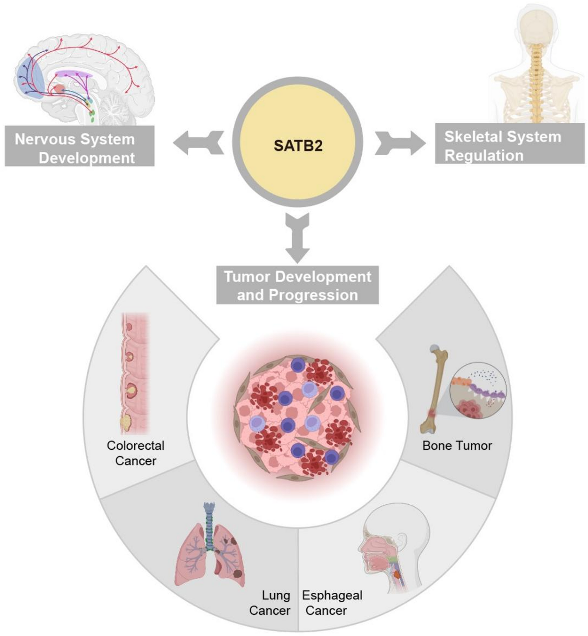 Advances in research on SATB2 and its role in tumor development