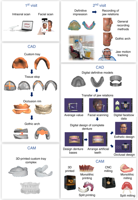 Expert consensus on digital restoration of complete dentures