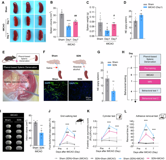 CD8+GZMK+CD27+CCR7+ T cells mobilized by splenic sympathetic nerves aggravate brain ischemia‒reperfusion injury via CCL19-positive endothelial cells