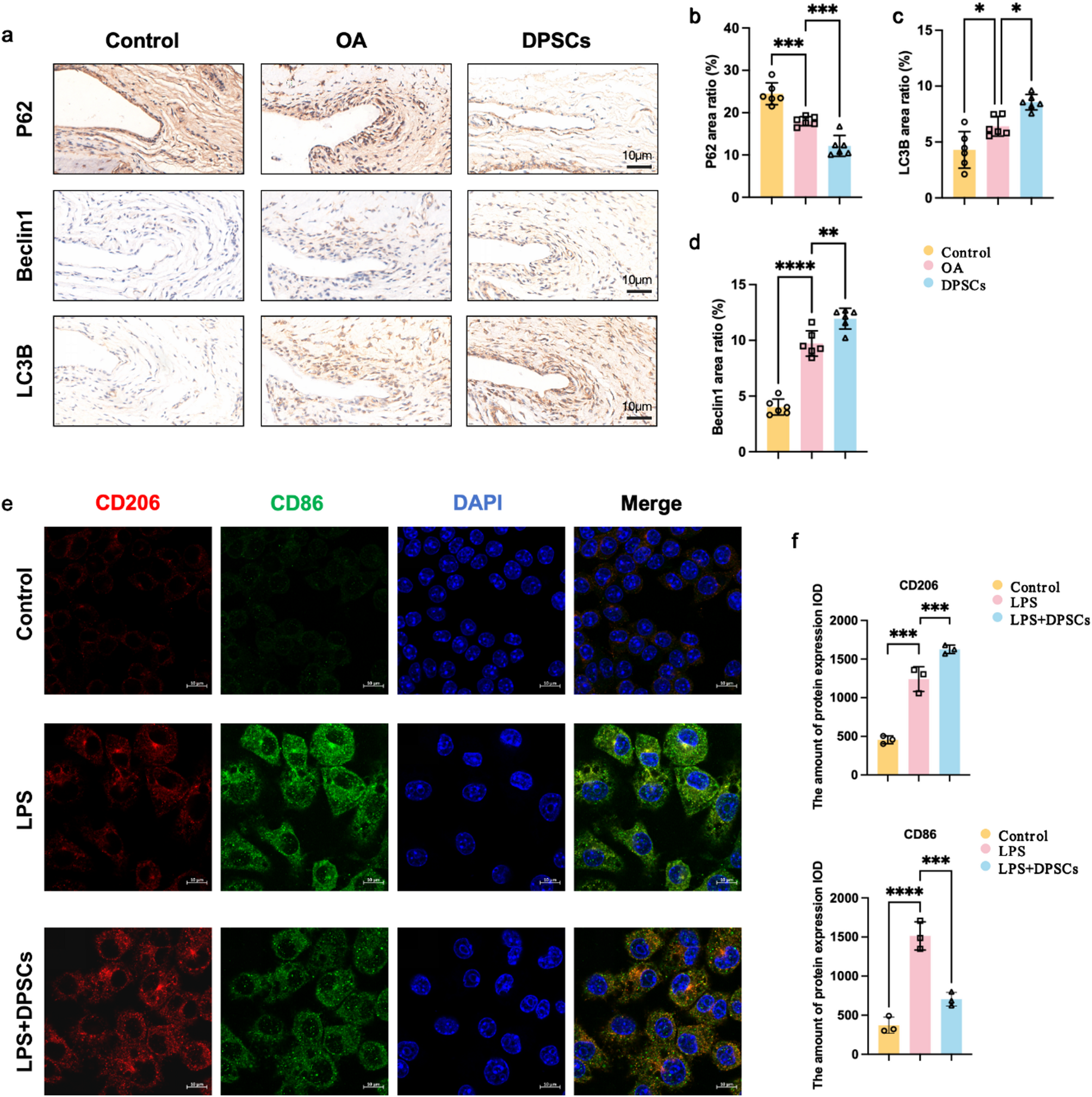 Correction: DPSCs modulate synovial macrophage polarization and efferocytosis via PINK1/Parkin-dependent mitophagy