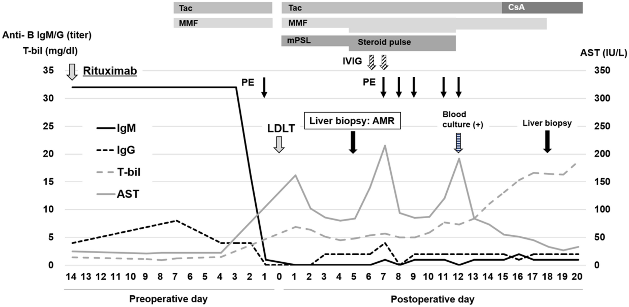 Antibody-mediated rejection without elevated anti-blood type antibody after ABO-incompatible living donor liver transplantation: a case report