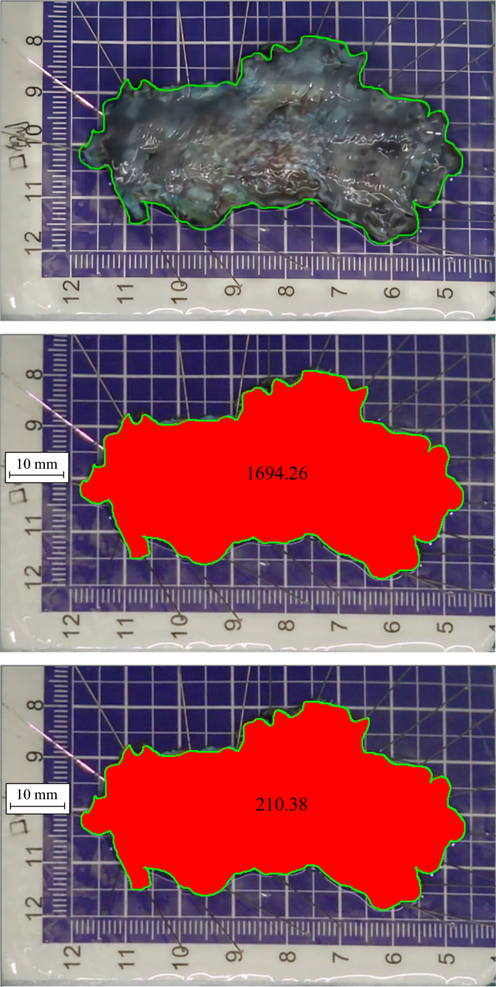 Endoscopic Image-Based Prediction of Esophageal Stenosis after ESD Using Mucosal Defect Metrics