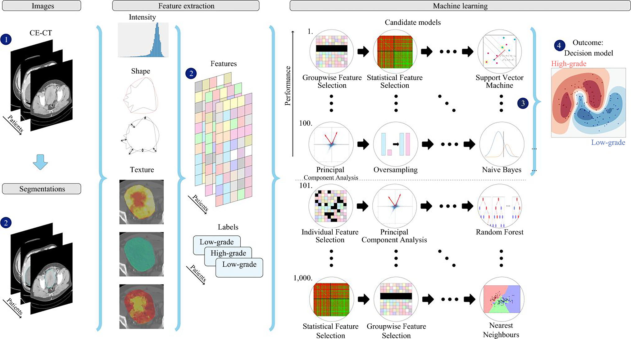 Evaluation of Diagnostic Accuracy of Preoperative CT-Based Radiomics in Primary Retroperitoneal Sarcoma