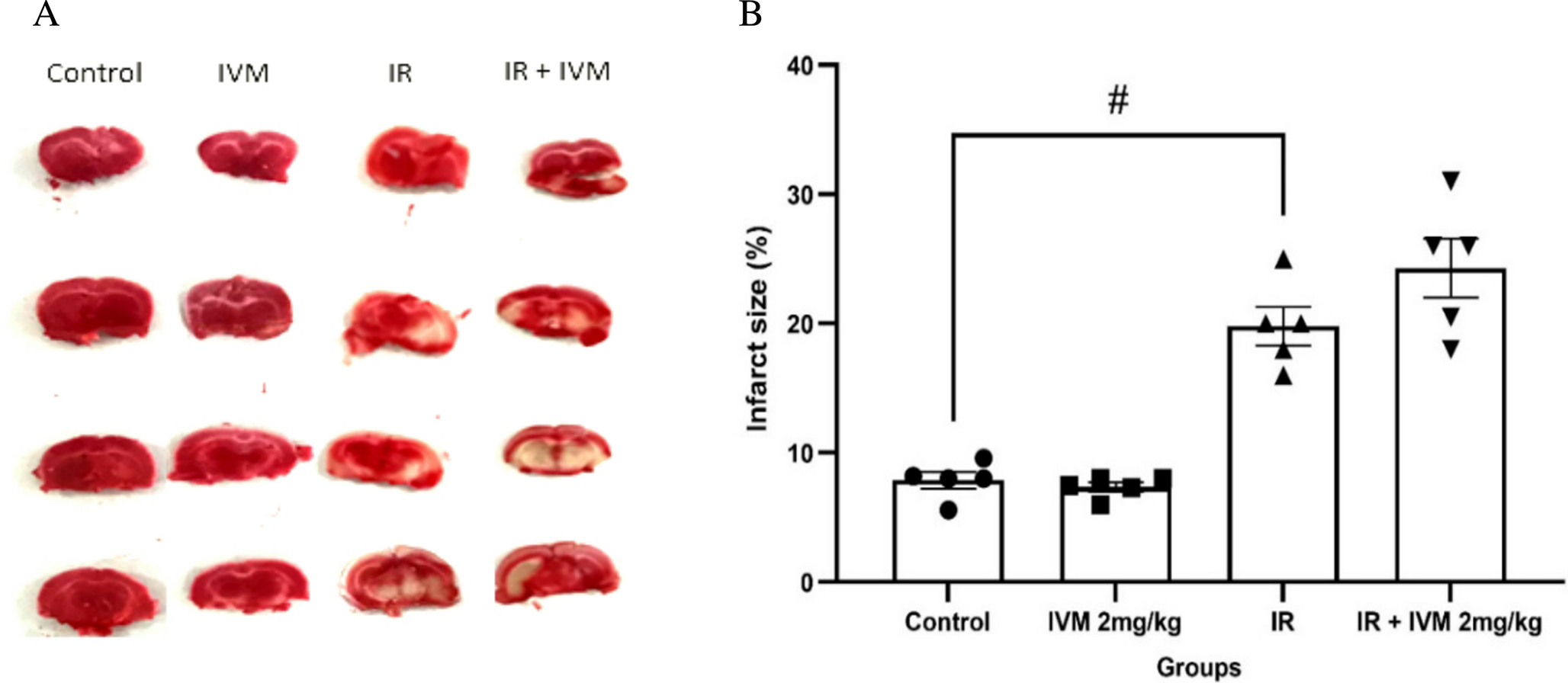 Ivermectin’s neuroprotective effects decrease with prolonged use after cerebral ischemia/reperfusion