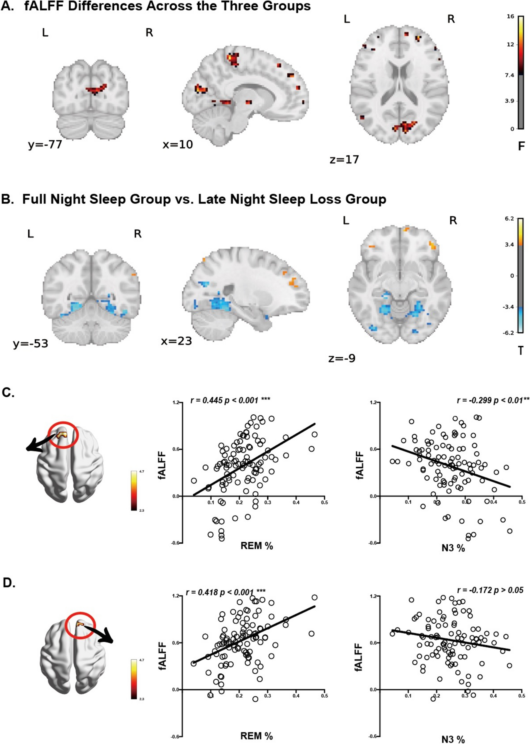 Differential Resting-State Brain Activity Following Early- and Late-Night Sleep Loss
